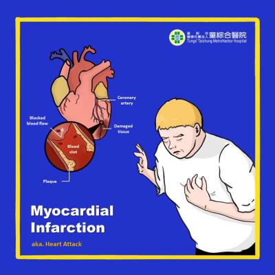 Myocardial Infarction