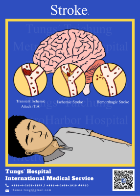 Types Of Strokes