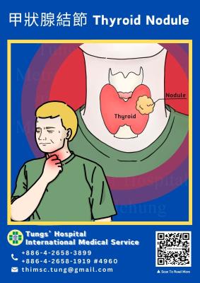 Thyroid Nodule
