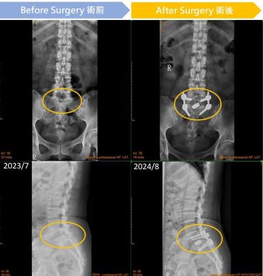 In the left image, the circled area appears cloudy, indicating inflammation; in the right image, the