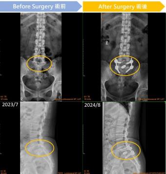 In the left image, the circled area appears cloudy, indicating inflammation; in the right image, the