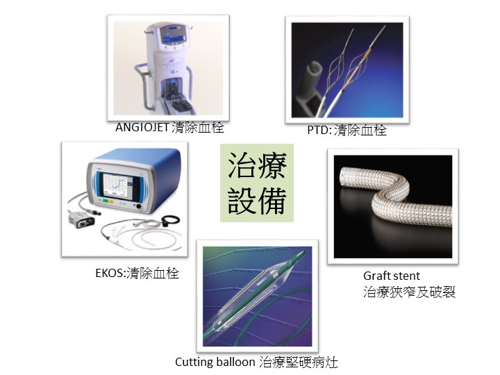 Endovascular thrombectomy of dialysis vascular access_ cure equipment