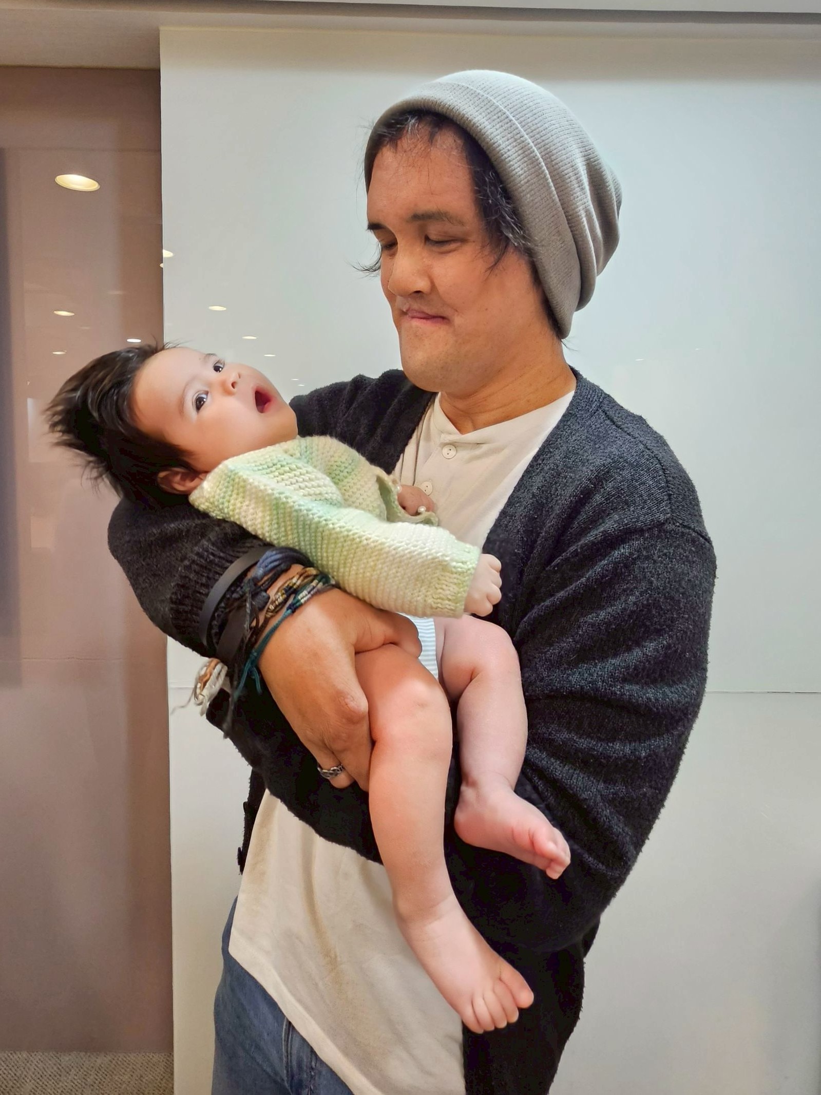 Mr. Li was born with EEC syndrome, a rare genetic disorder, resulting in three fingers on each hand. With the assistance of the Reproductive Medicine Center at Taipei Medical University Hospital, he welcomed a daughter with ten fingers.。